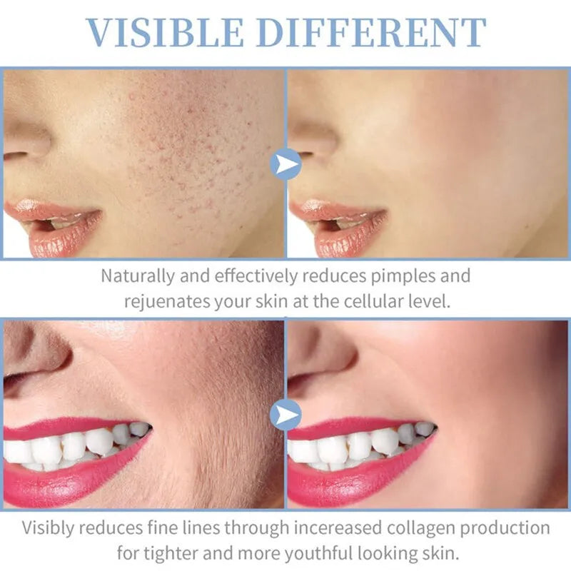 Portable Skin Therapy Wand Machine