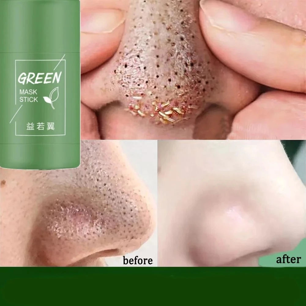 Blackhead Green Tea Solid Mask