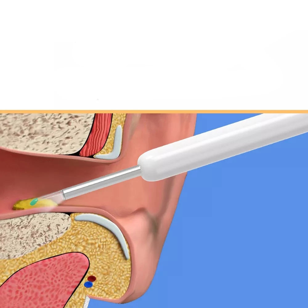 NE3 Ear Cleaner High Precision Ear Wax